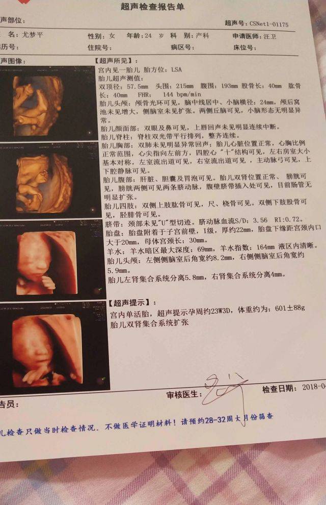 怀孕37周后，怎么知道宝宝何时发动？从这三点可以看出来（图1）