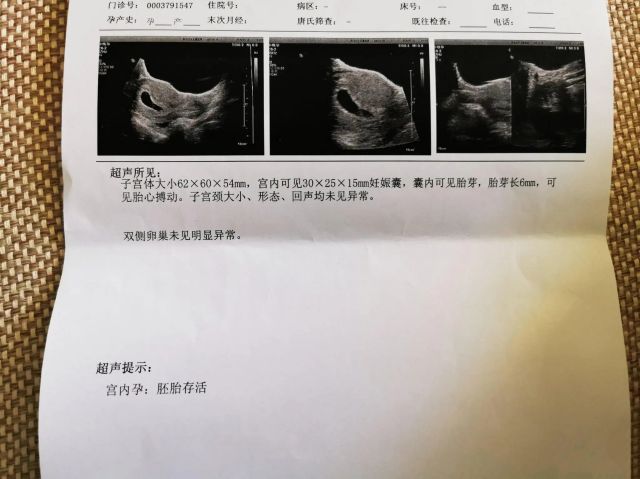泰国试管婴儿怀孕后几周能看到胎心？（图1）