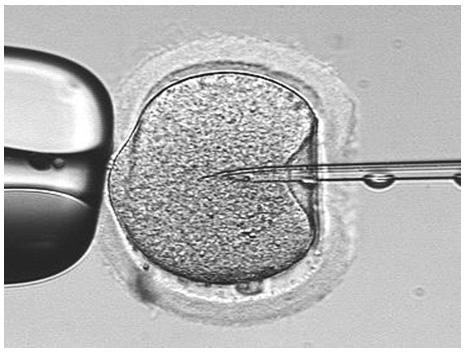 大龄夫妻两年备孕未果，美国三代试管婴儿一次助孕成功