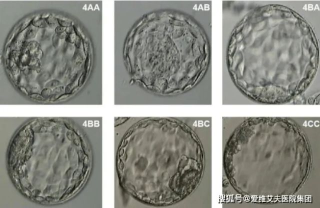 泰国试管婴儿移植是鲜胚好还是冻胚好？