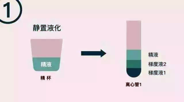 泰国试管婴儿的洗精术是用来挑选Y精子的吗?