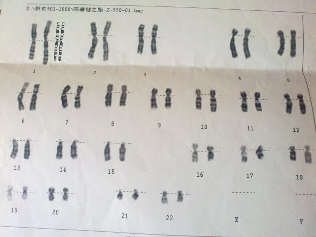 有染色体异位的问题，去泰国试管可以吗？（图2）