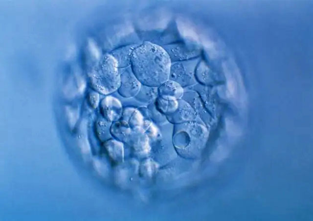 试管婴儿囊胚培养的优势和劣势（图3）
