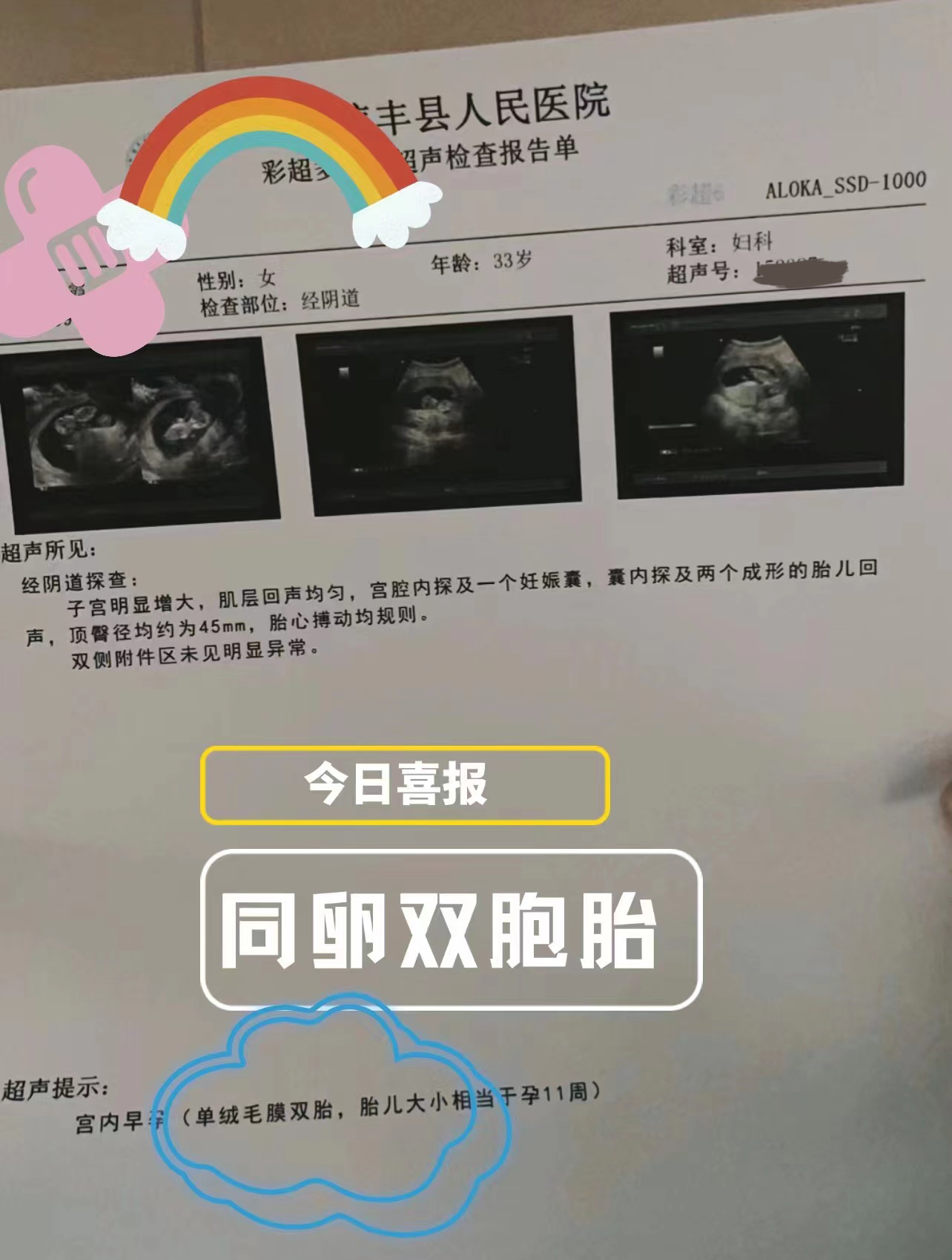 31岁因为想生儿子，去泰国做第三代试管婴儿，一次就中奖（图1）