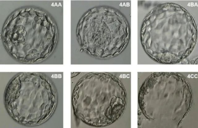 胚胎 (7).jpg
