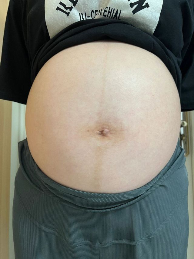 27岁备孕二胎，在泰国杰特宁医院做泰国第三代试管婴儿生男宝经验分享（图1）