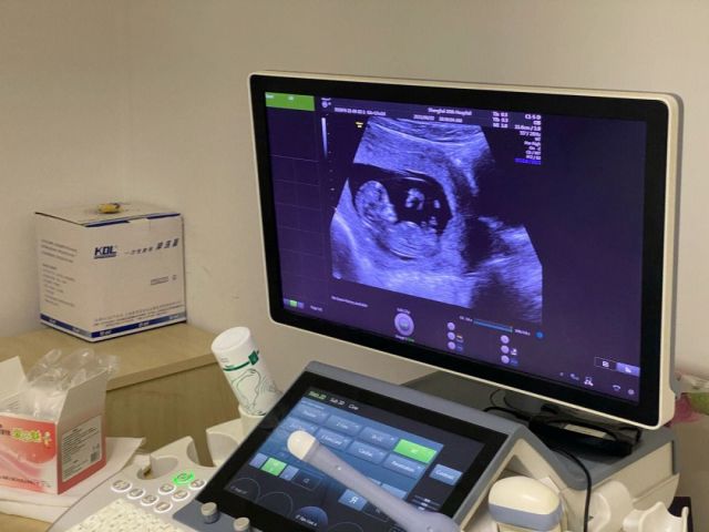 说说我在泰国暹罗生殖中心的试管婴儿经历，已怀孕6个月，撒好孕!