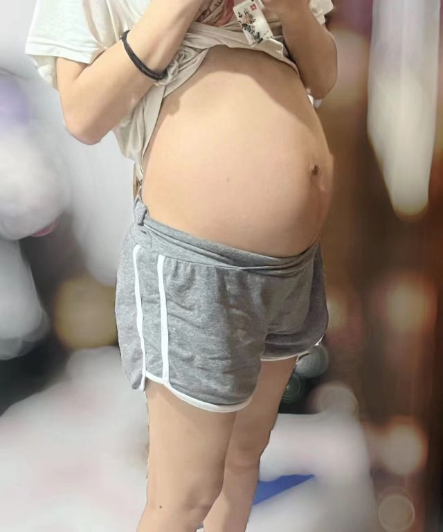 泰国试管婴儿亲身经历，染色体平衡易位，终于拥有自己的宝宝了!（图3）