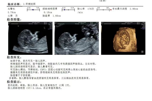 子宫内膜异位症不孕，选择做海外试管婴儿，感谢上天让我们遇见（图1）