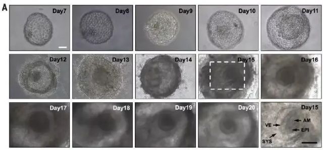 精子畸形+胎停+输卵管堵塞，泰国试管婴儿治疗一次成功（图2）