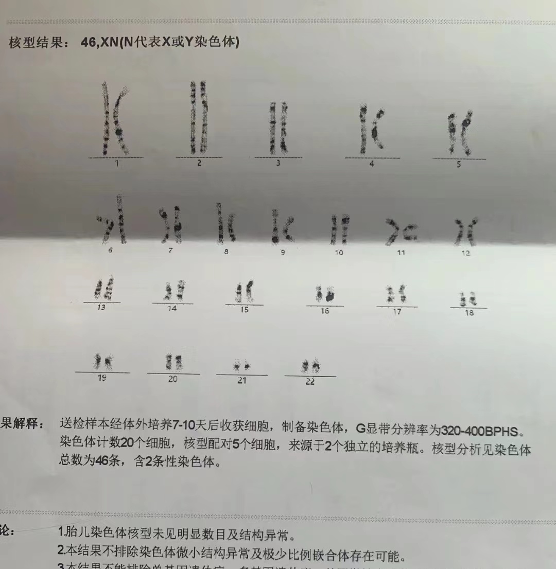 染色体异常第三代试管能解决吗?费用是多少?（图2）