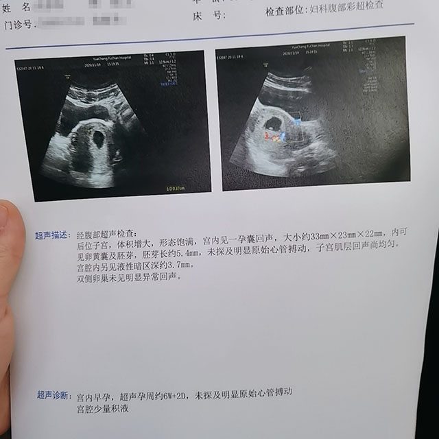 八年求子路一促四移生化胎停转战三代试管一次成功（图2）