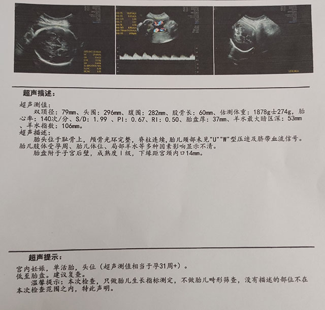 潮州做第三代试管婴儿生儿子的真实经历（图3）