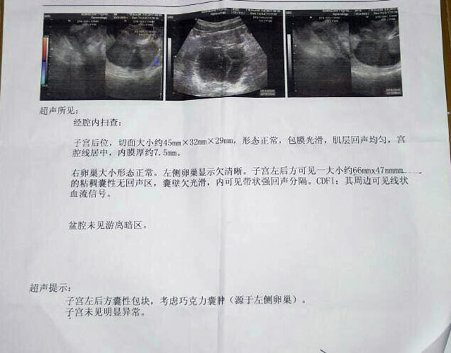 巧囊做几代试管比较好?巧囊试管相关问题集锦!（图1）