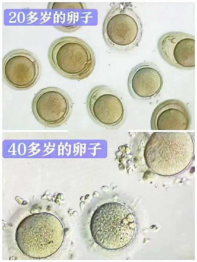 揭秘河南供卵机构：专家建议与实用经验分享 (揭秘河南供卵视频)