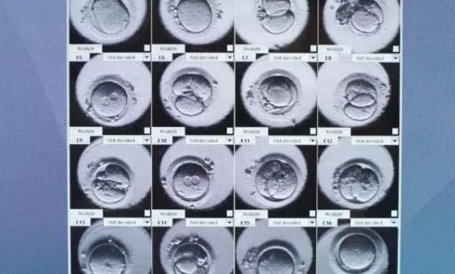 试管胚胎着床的12种征兆?看看你中了几种？
