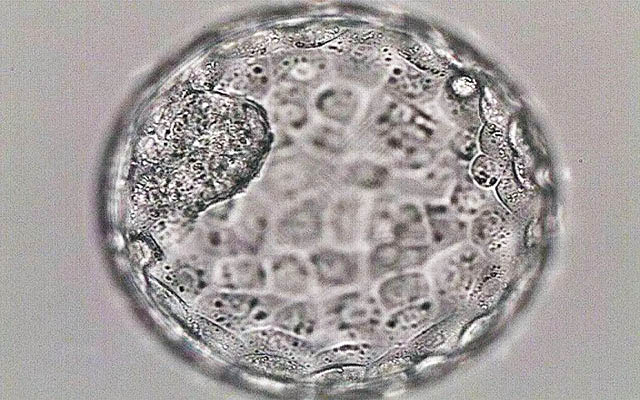 6天囊胚和5天囊胚区别