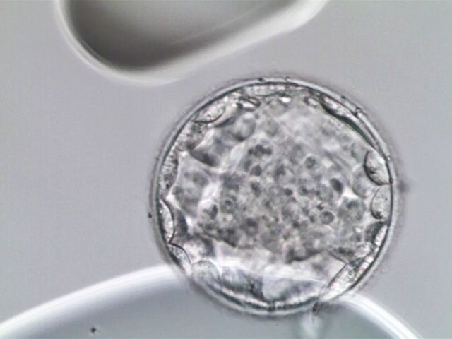 只有2个胚胎为什么全部养囊
