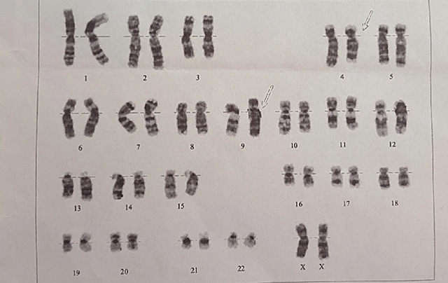 染色体.jpg