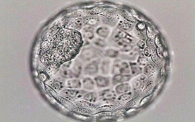 做试管第六天囊胚说明胚胎质量差吗