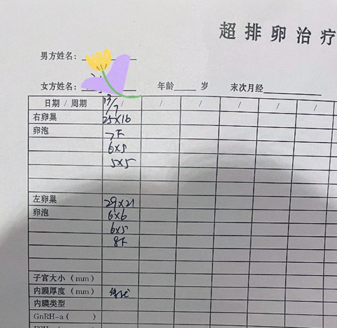 ppos方案和拮抗剂方案的区别