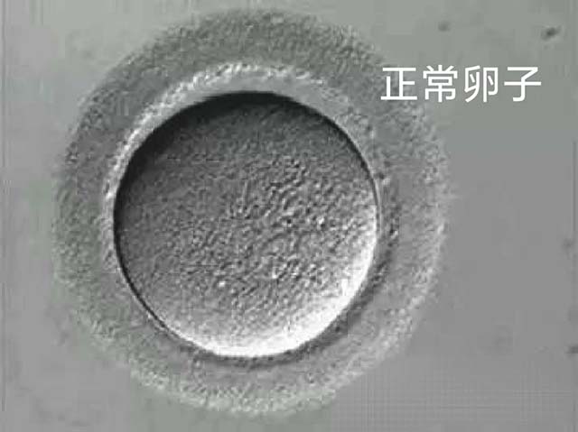 去新加坡做试管婴儿可以筛选男女胚胎吗?