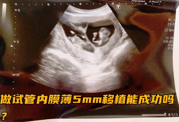 做试管内膜薄5mm移植能成功吗？.jpg