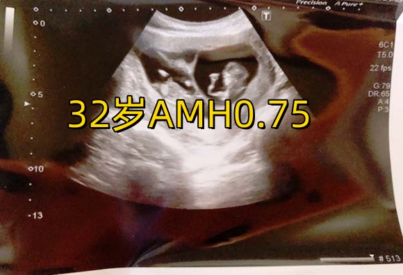 32岁女性AMH0.75做试管还有希望怀孕吗